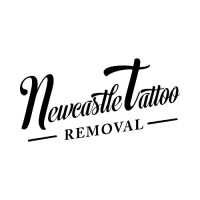 Newcastle Tattoo Removal Logo