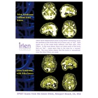 Abilities OT & Irlen Diagnostic Center Logo