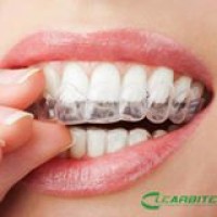 Clearbite Aligners Logo