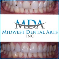 Midwest Dental Arts, Inc Logo