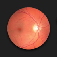Ophthalmic Instruments, Inc./Lombart Instrument Logo
