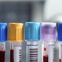 Biobank Väst Logo