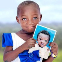 Operation Smile South Africa Logo