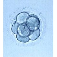 Embryo Adoption Services of Cedar Park Logo