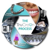 TruCrown Logo