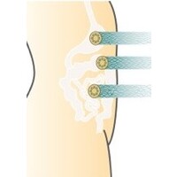 G-Tech Medical Logo