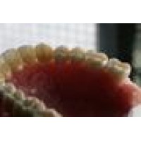 Smith Haist Dental Lab Logo