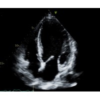 The Arizona Society of Echocardiography Logo