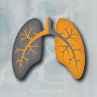 Ventilatory Support Group SA de CV Logo