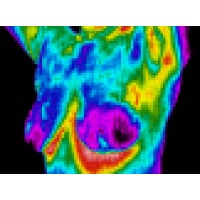 The Breast Thermography Institute Logo