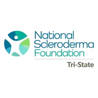 National Scleroderma Foundation Tri-State Chapter Logo