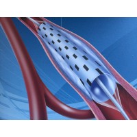 NuCryo Vascular, Inc. Logo